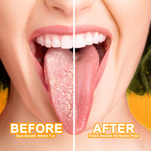 Homlly Tongue Scraper Oral Cleaner Dental Kit Adults & Kids
